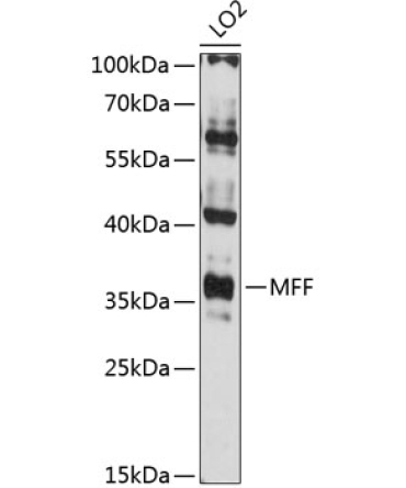 MFF Rabbit Polyclonal Antibody