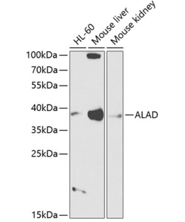 ALAD Rabbit Polyclonal Antibody