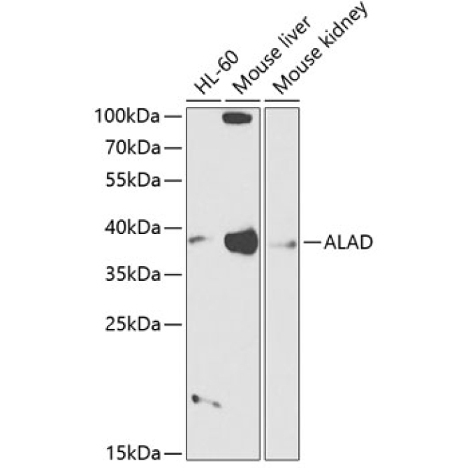 ALAD Rabbit Polyclonal Antibody