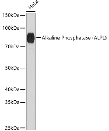 Alkaline Phosphatase (ALPL) Rabbit Polyclonal Antibody