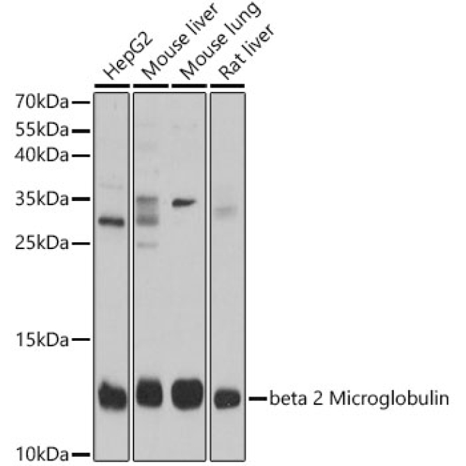 beta 2 Microglobulin Rabbit Polyclonal Antibody
