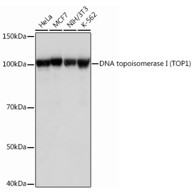 DNA topoisomerase I (TOP1) Rabbit Monoclonal Antibody