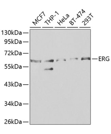 ERG Rabbit Polyclonal Antibody
