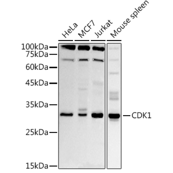 CDK1 Rabbit Polyclonal Antibody