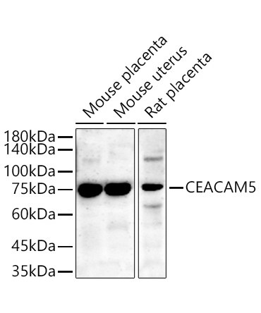 CEACAM5 Rabbit Polyclonal Antibody