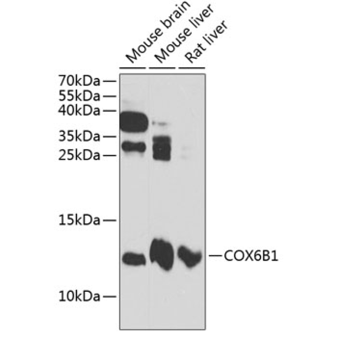 COX6B1 Rabbit Polyclonal Antibody