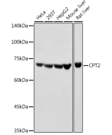 CPT2 Rabbit Polyclonal Antibody
