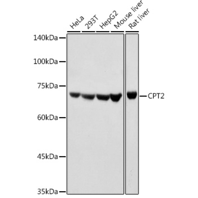 CPT2 Rabbit Polyclonal Antibody