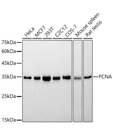 PCNA Rabbit Monoclonal Antibody