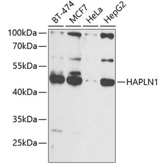HAPLN1 Rabbit Polyclonal Antibody