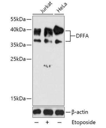 DFFA Rabbit Polyclonal Antibody