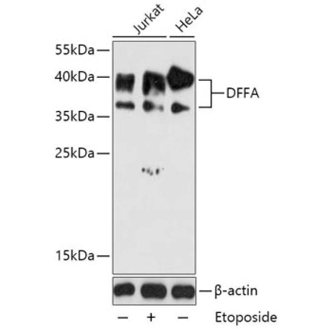 DFFA Rabbit Polyclonal Antibody
