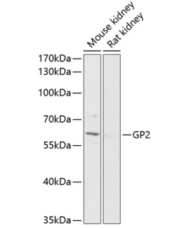 GP2 Rabbit Polyclonal Antibody