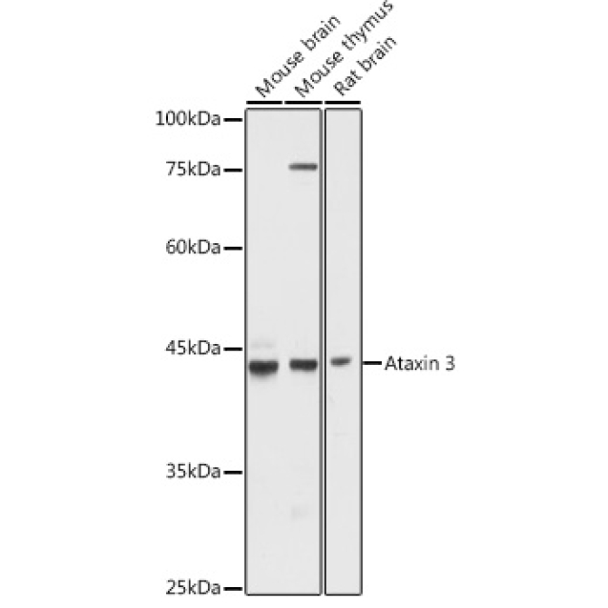 Ataxin-3 (ATXN3) Rabbit Polyclonal Antibody