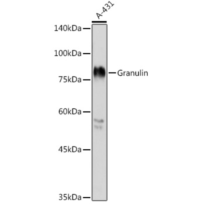 Granulin Rabbit Polyclonal Antibody
