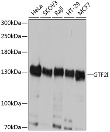 GTF2I Rabbit Polyclonal Antibody