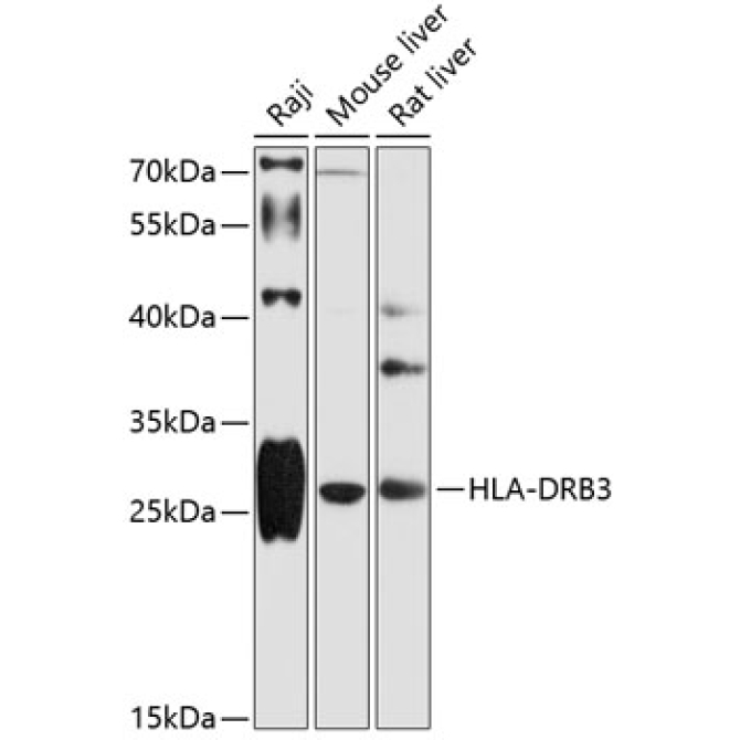 HLA-DRB3 Rabbit Polyclonal Antibody
