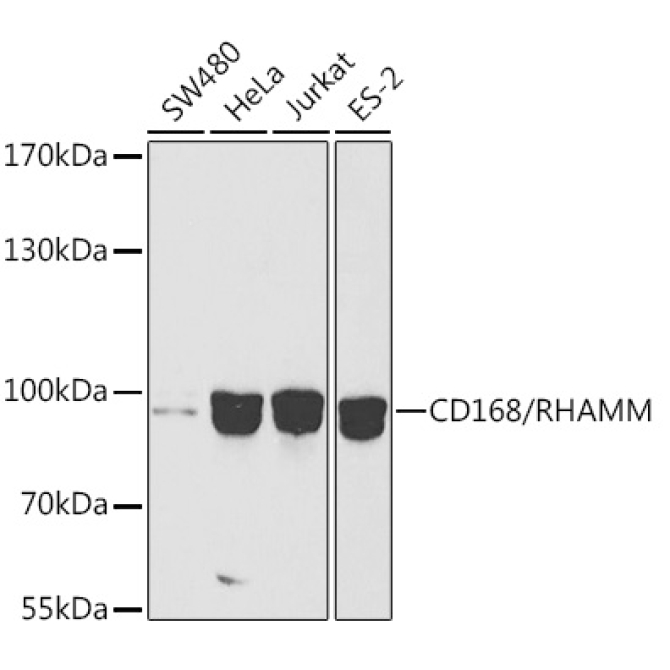 CD168/RHAMM Rabbit Polyclonal Antibody [KO Validated]