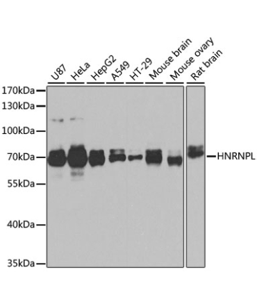 HNRNPL Rabbit Polyclonal Antibody