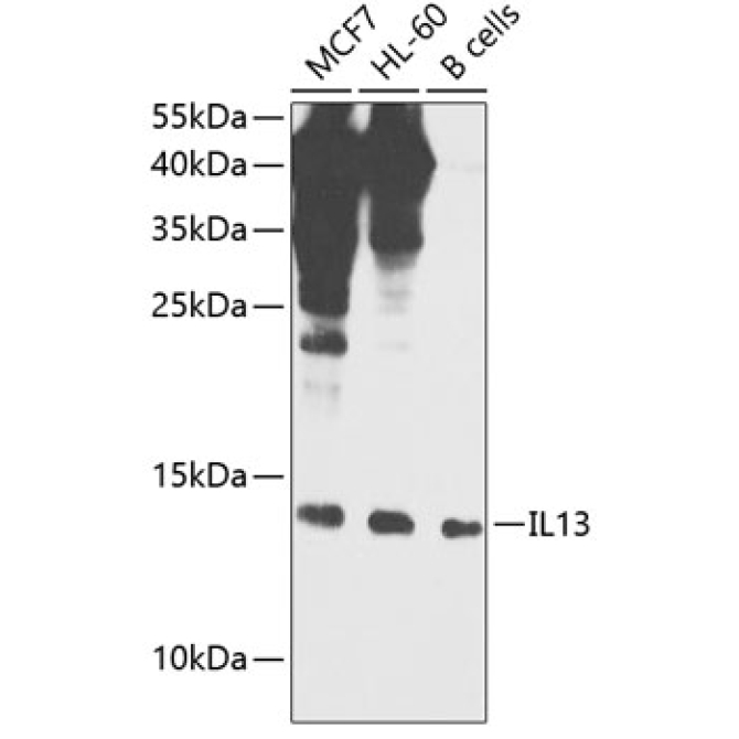 IL13 Rabbit Polyclonal Antibody