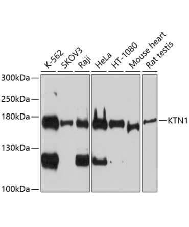 KTN1 Rabbit Polyclonal Antibody