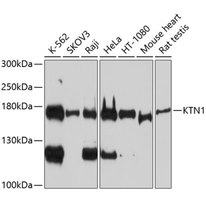 KTN1 Rabbit Polyclonal Antibody