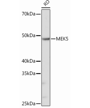 MEK5 Rabbit Monoclonal Antibody