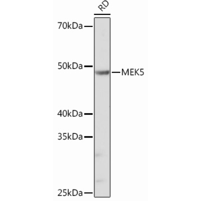 MEK5 Rabbit Monoclonal Antibody