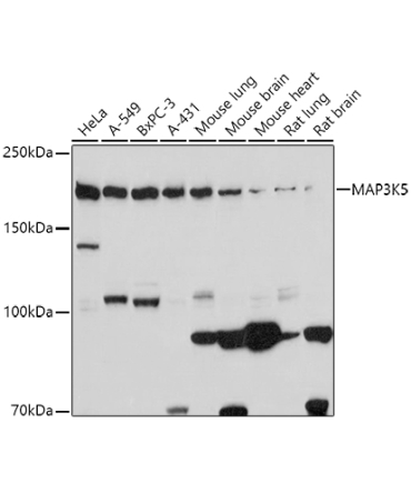 MAP3K5 Rabbit Polyclonal Antibody