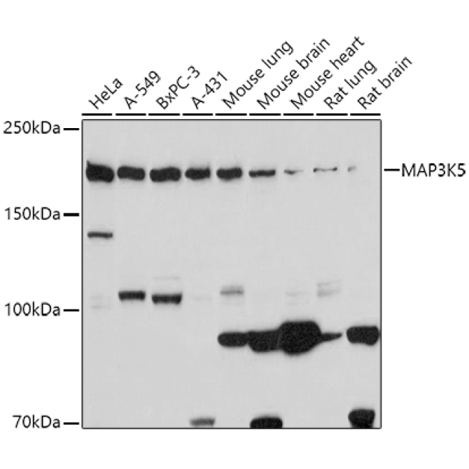 MAP3K5 Rabbit Polyclonal Antibody