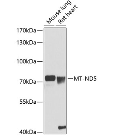 MT-ND5 Rabbit Polyclonal Antibody