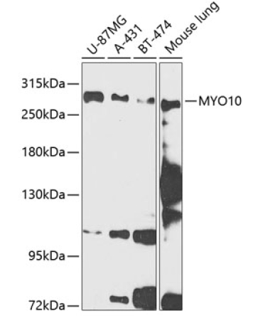 MYO10 Rabbit Polyclonal Antibody