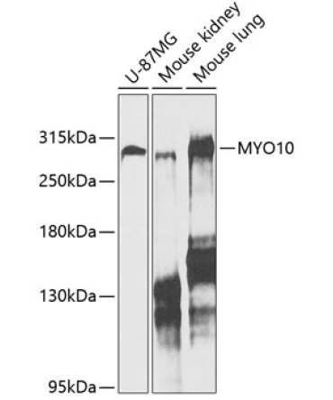 MYO10 Rabbit Polyclonal Antibody