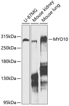 MYO10 Rabbit Polyclonal Antibody