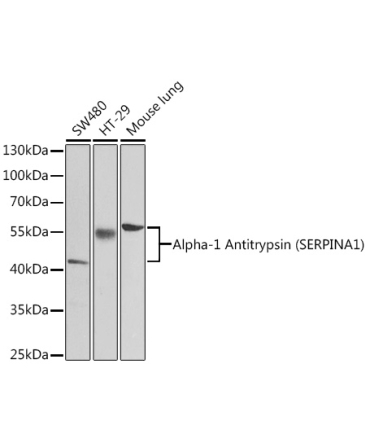 Alpha-1 Antitrypsin (SERPINA1) Rabbit Polyclonal Antibody