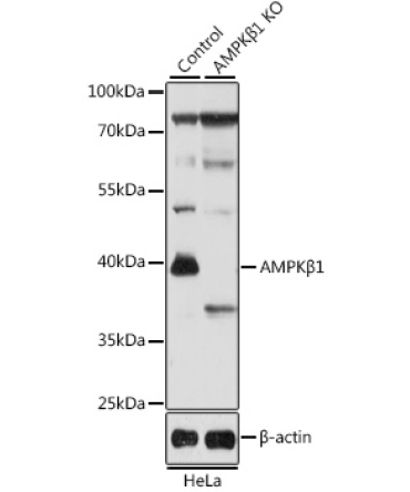 AMPKBeta1 Rabbit Polyclonal Antibody [KO Validated]