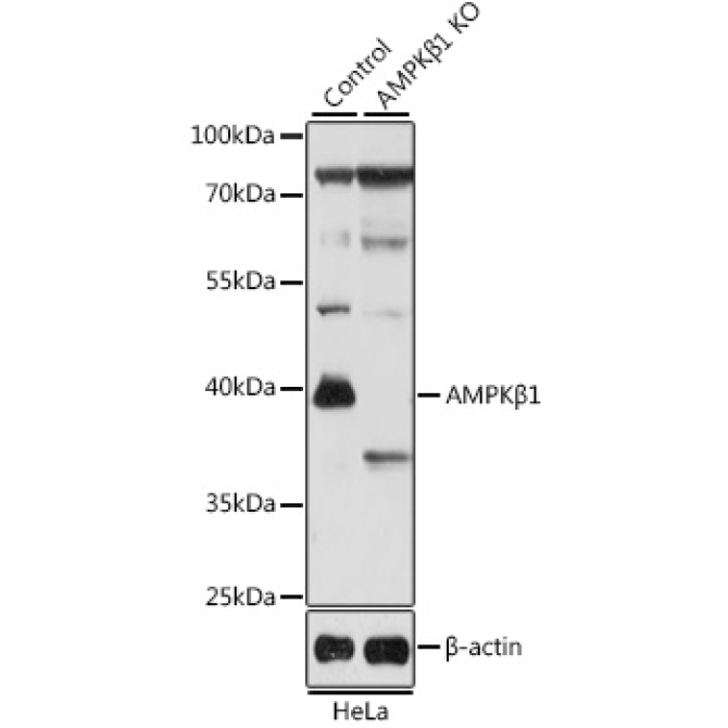 AMPKBeta1 Rabbit Polyclonal Antibody [KO Validated]