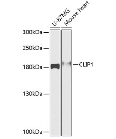 CLIP1 Rabbit Polyclonal Antibody