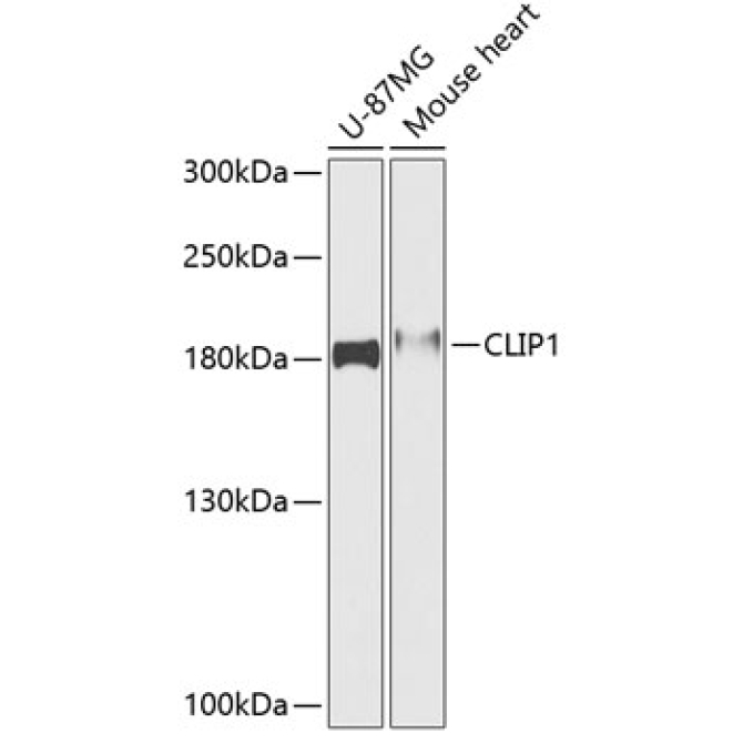 CLIP1 Rabbit Polyclonal Antibody