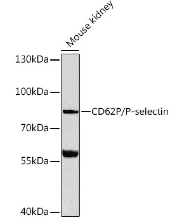 CD62P/P-selectin Rabbit Polyclonal Antibody