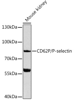 CD62P/P-selectin Rabbit Polyclonal Antibody