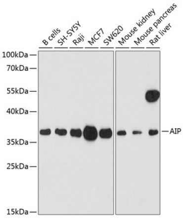 AIP Rabbit Polyclonal Antibody