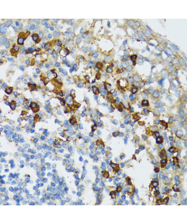 Bim Rabbit Polyclonal Antibody