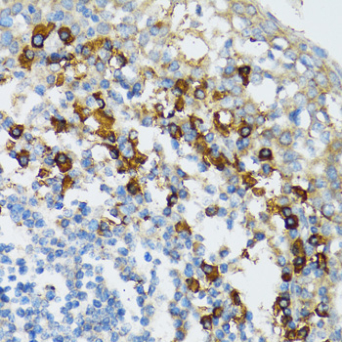 Bim Rabbit Polyclonal Antibody