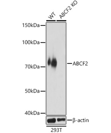 ABCF2 Rabbit Polyclonal Antibody [KO Validated]
