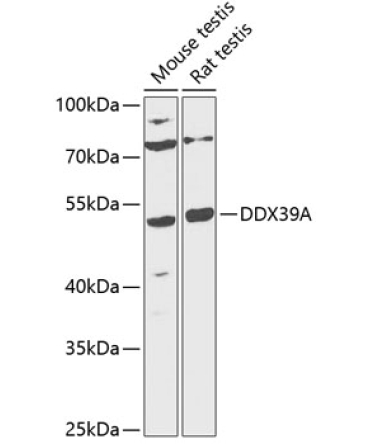 DDX39A Rabbit Polyclonal Antibody