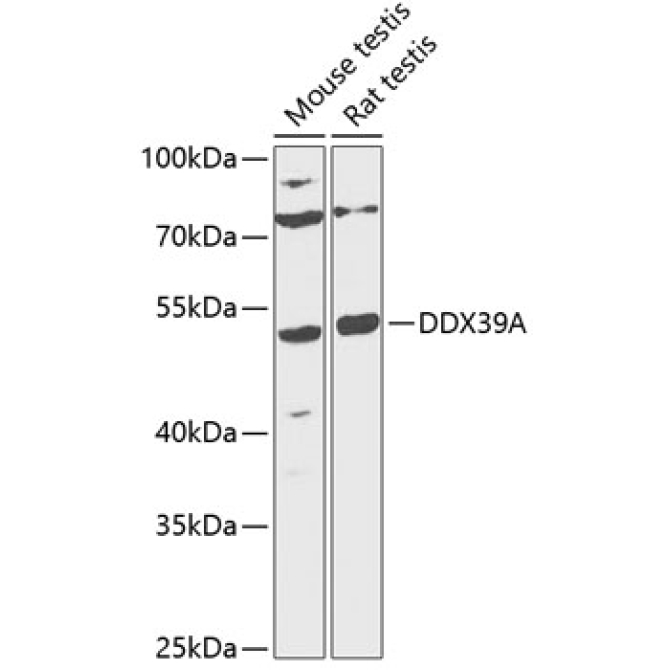 DDX39A Rabbit Polyclonal Antibody