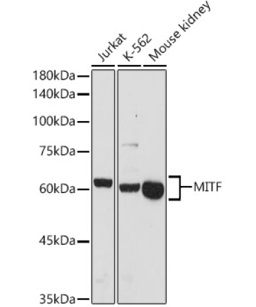 MITF Rabbit Polyclonal Antibody