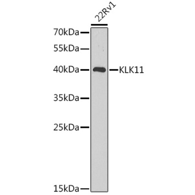 KLK11 Rabbit Polyclonal Antibody