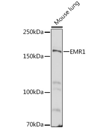 EMR1 Rabbit Polyclonal Antibody